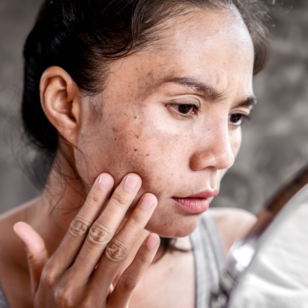 Navigating the World of Blemishes and Scars